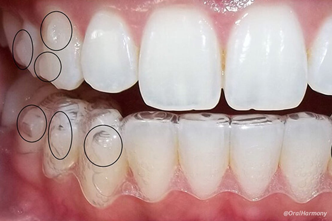 Oral Harmony Ortodoncia Invisible